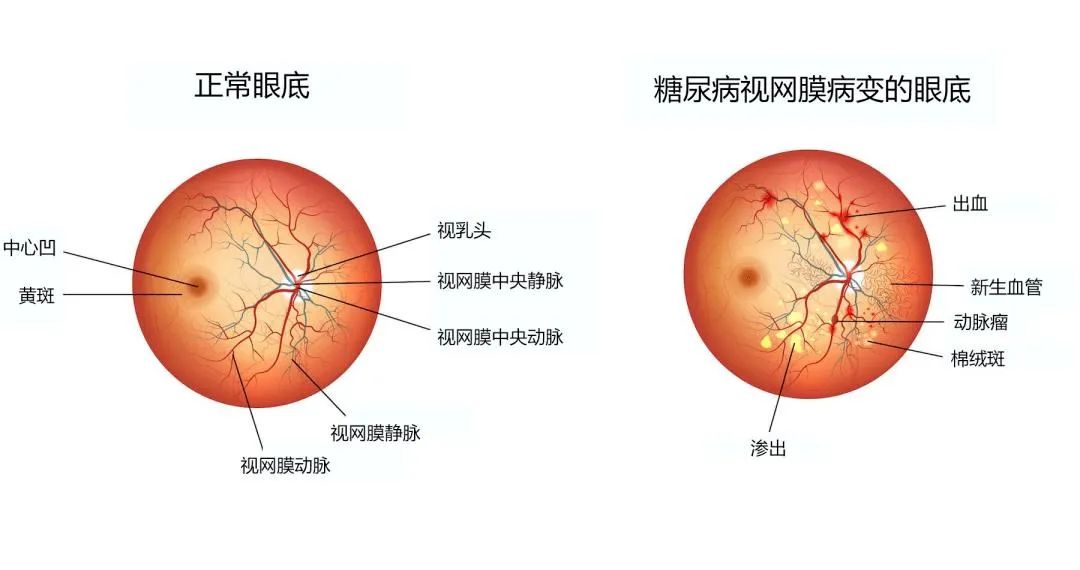 不限户籍！这项免费检查开始啦