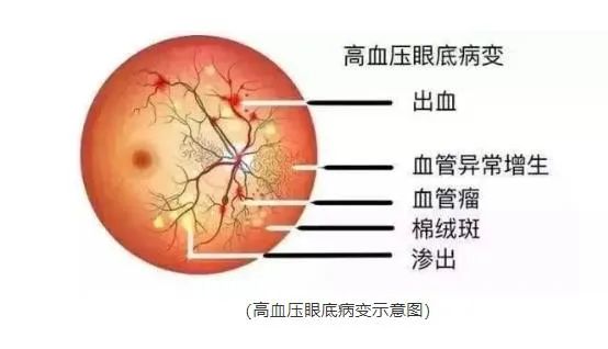 不限户籍！这项免费检查开始啦