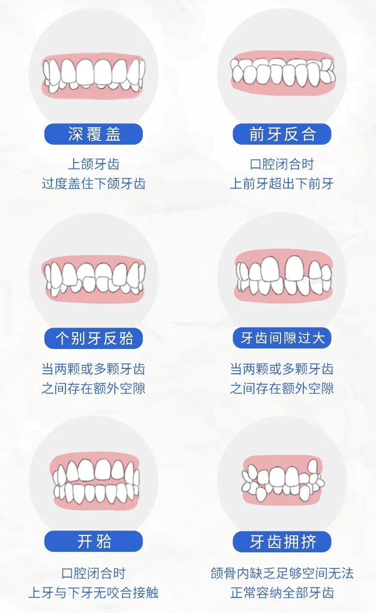 【免费口扫·三店通用】 科学矫牙，放“夏”烦恼，歪牙立正！